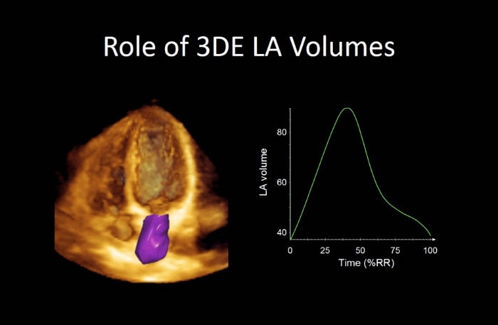 Role of 3DE LA Volumes
