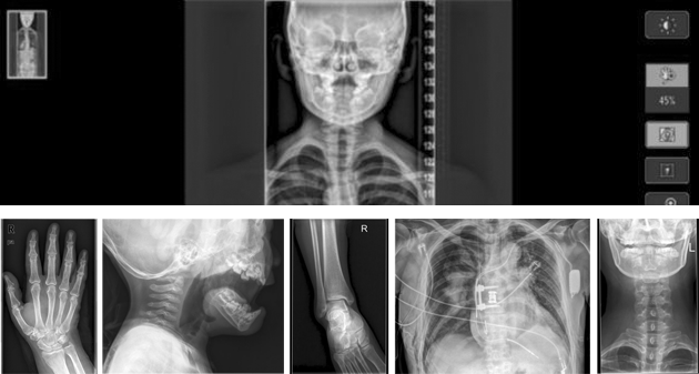 UNIQUE X-ray image Processing Software