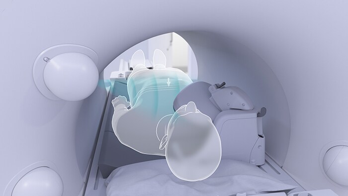 Photo of an MR imaging system and patient with touchless patient sensing to prepare for the scan