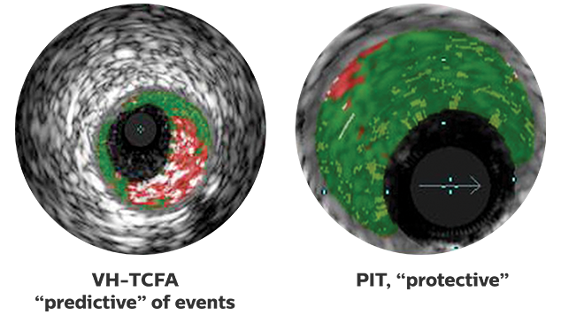 VhIvus clinical applications