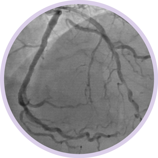 diffuse disease bubble