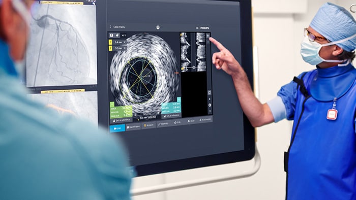 Coronary IVUS - Intravascular Ultrasound