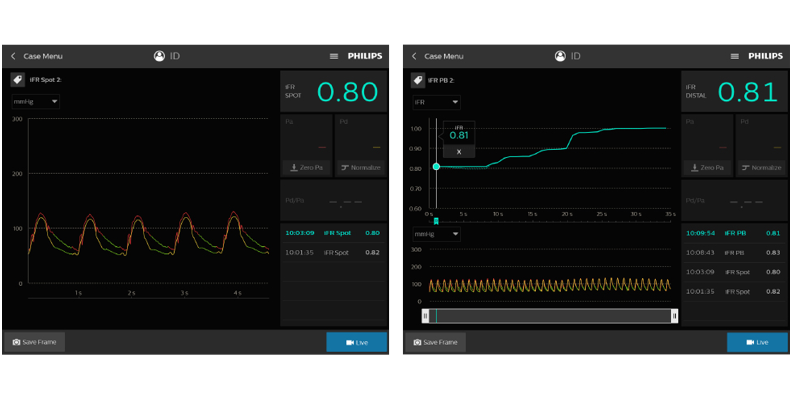 Ifr monitor download image