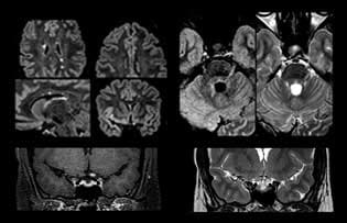 clinical case image