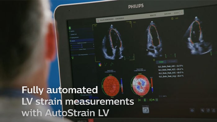 Fully automated LV strain measurements with AutoStrain LV.