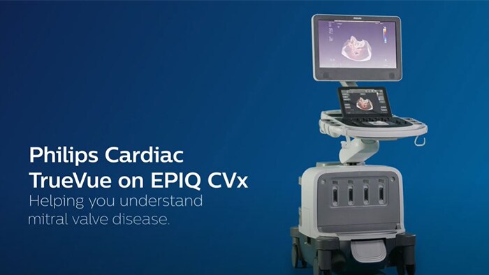Philips Cardiac TrueVue on EPIQ CVx.