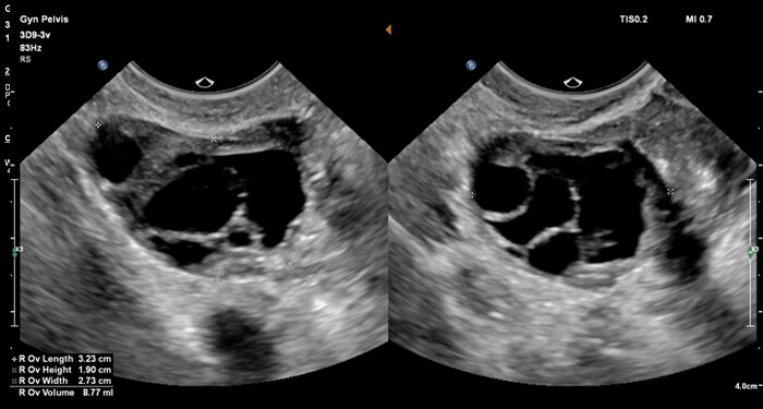 3D9-3v Ov Dual with measurements MaxVue