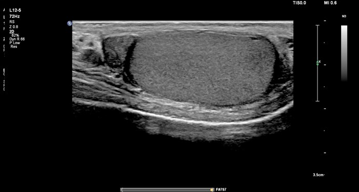 L12-5 Testicle MaxVue