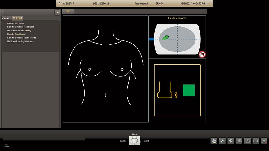 AI Breast Registration Screen