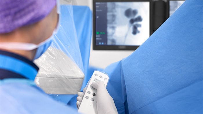 Mobile C-arms for gastroenterology | Urology