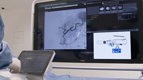 Interventional radiology video