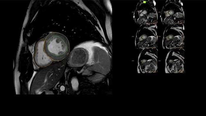 Accelerate workflow for your cardiac exams