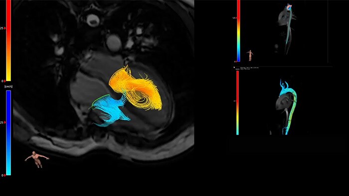 Visualize and evaluate blood flow