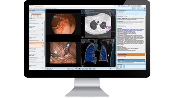 clinical repository image on computer screen