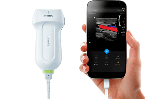telexy qview telexy qview