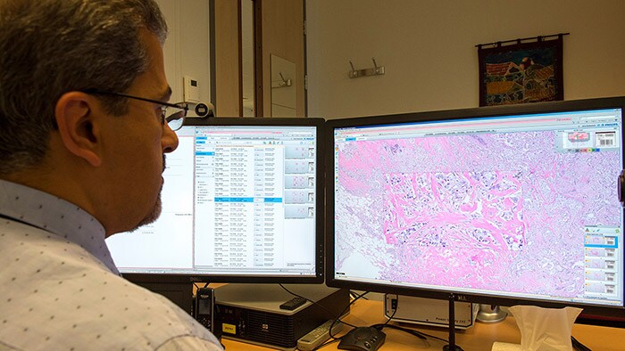 Digital Pathology | Philips