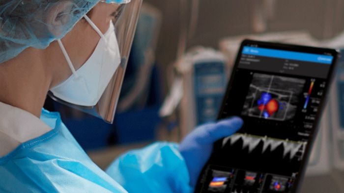 Lumify device on critical care