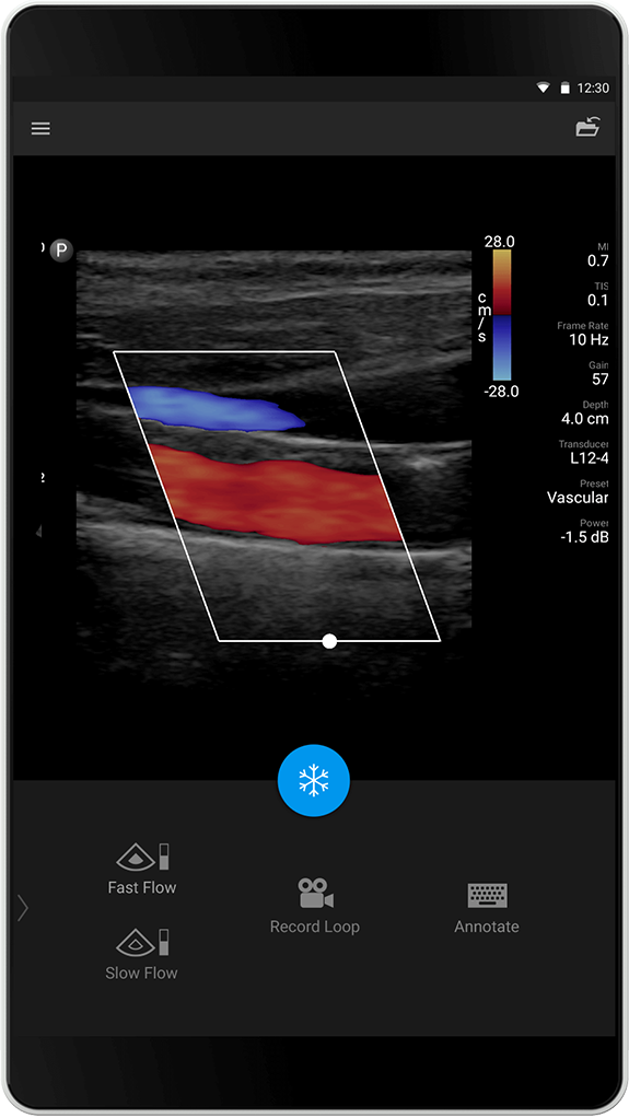 Vascular exam L12-4