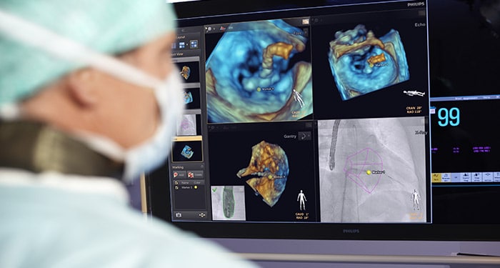Treating structural heart disease with image-guided intervention