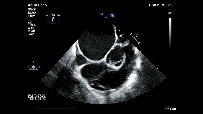 2D and 3D transthoracic and transesophagealdiagnostic transducers