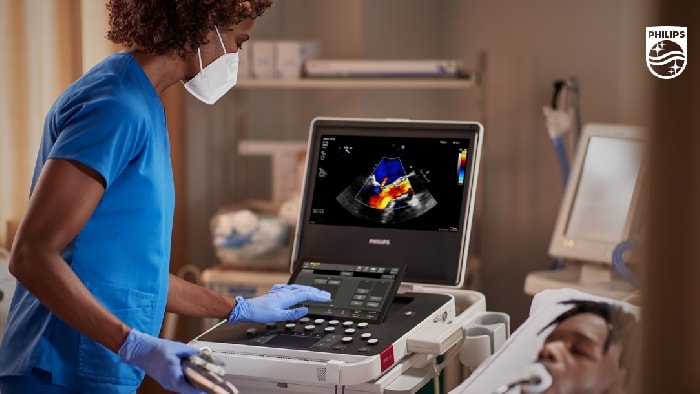 epiq 7 ultrasound machine