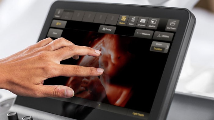 Practitioner's hand on TouchVue  OB ultrasound machine