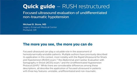 rush restructured zmag thumbnail