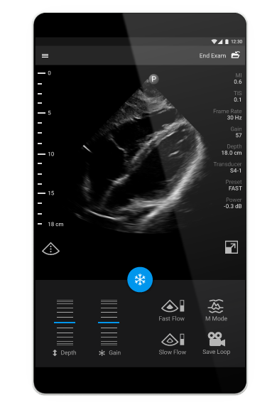 A better vision for mobile ultrasound