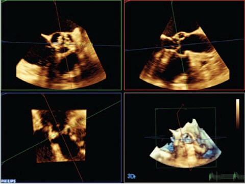 high definition imaging