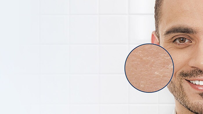 How to prevent dry and tight skin