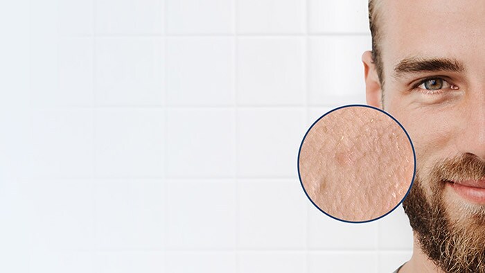 Solve dry and tight skin