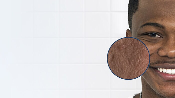 The truth about dry and tight skin