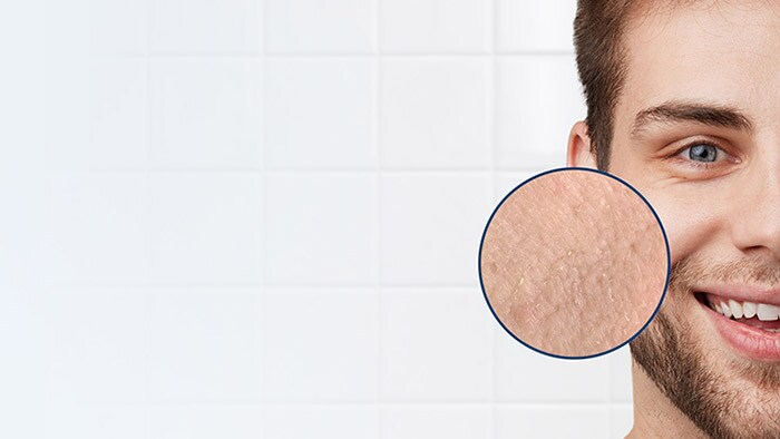 3 products for dry and tight skin