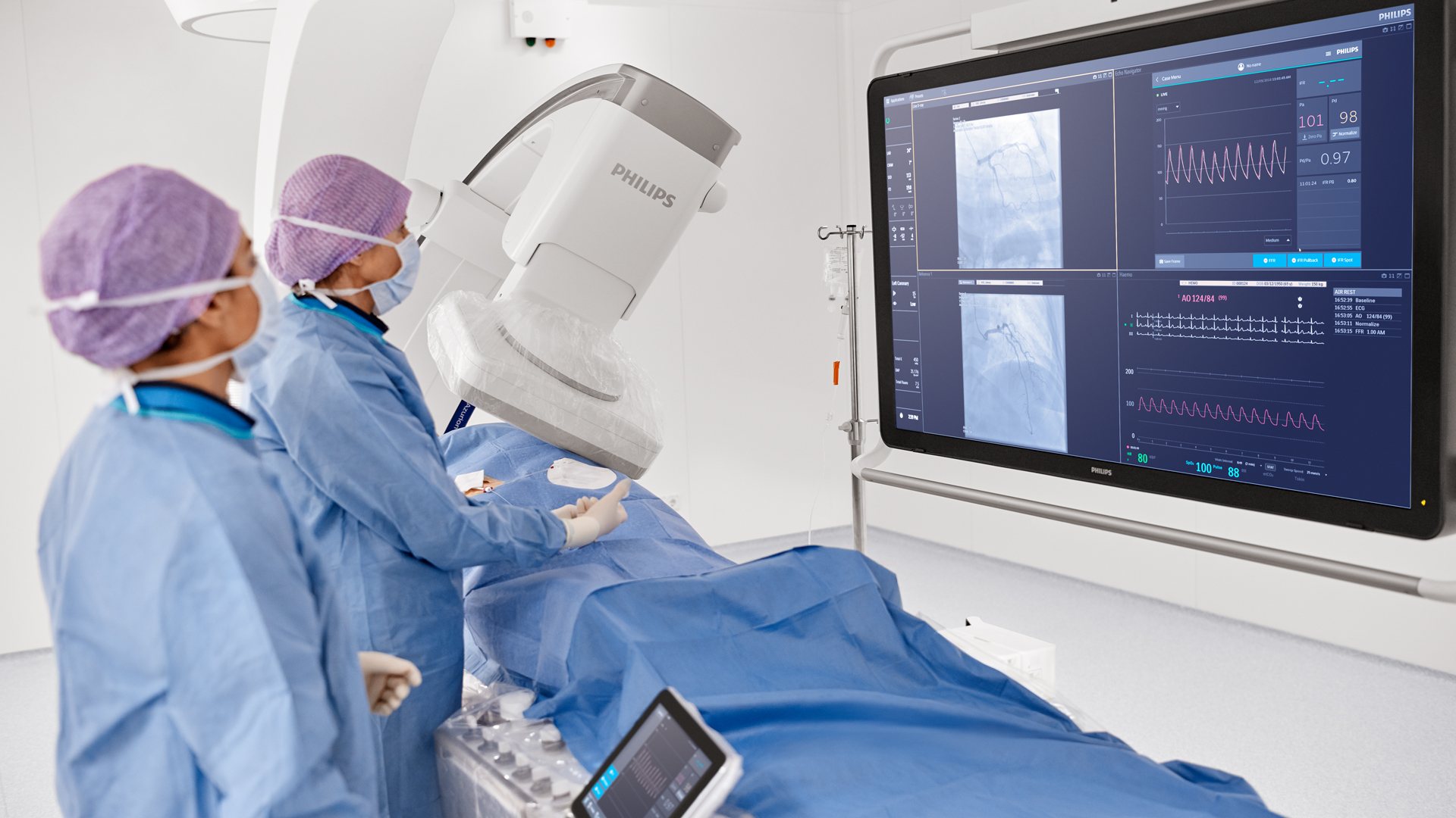 Philips’ latest Azurion image-guided therapy platform