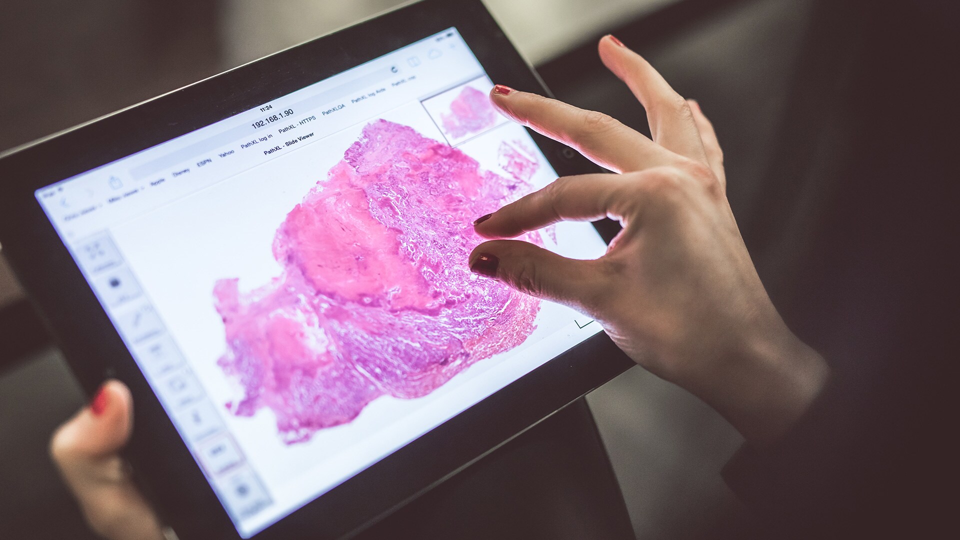 North West Anglia NHS Foundation Trust implements fully digital histopathology solution, resulting in improved clinical outcomes in complex cases