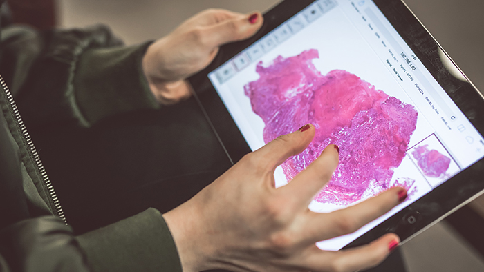 Case of the Month - Cell Injury and Adaptation