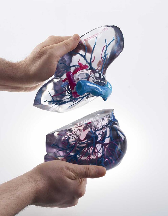 Download image (.jpg) Stratasys 3D Printed medical model built with PolyJet technology (opens in a new window)