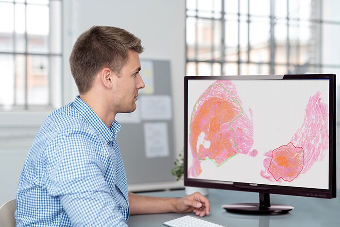 Download image (.jpg) Philips TissueMark aids in identifying insufficient samples for molecular tests with accurate cellularity guidance. (opens in a new window)