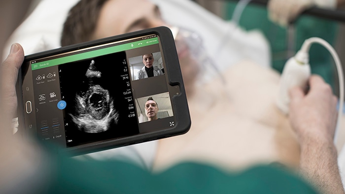 Philips receives FDA clearance for the use of its ultrasound portfolio to manage COVID-19-related lung and cardiac complications