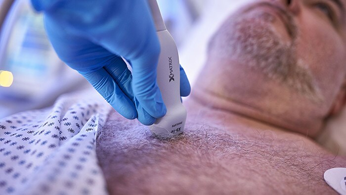 Philips introduces fully integrated echocardiography experience, bringing together new transducer technology, AI-driven automated measurements and remote access at EuroEcho 2021