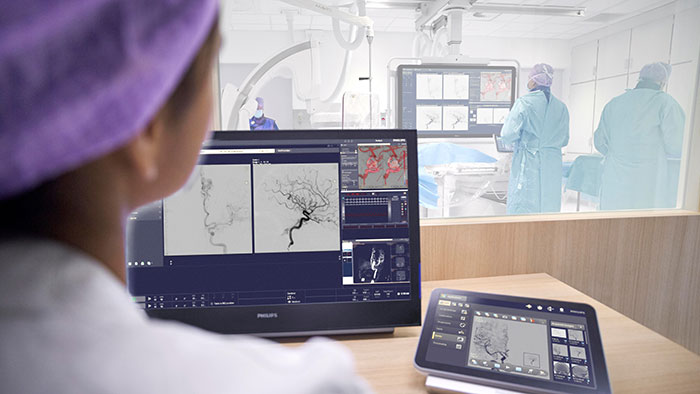 Philips calls for global action on stroke awareness and access to life-saving care